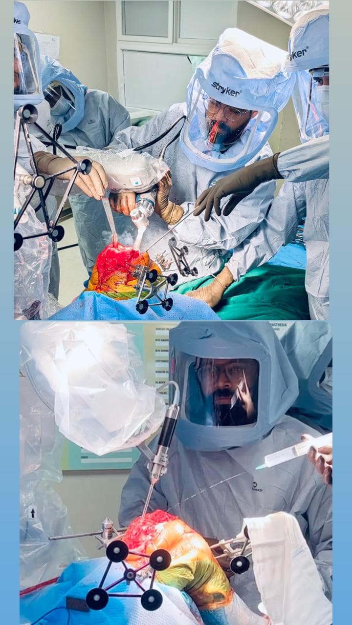 Dr. Adarsh Krishna K Bhat during robotic joint replacement surgery
