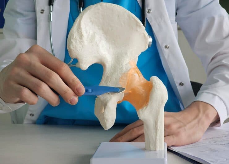 Hip Replacement in Active & Younger Adults: Longevity of Modern Ceramic Implants