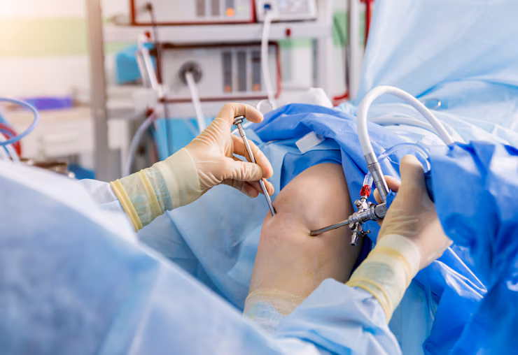 Arthroscopic instruments positioned at the knee during a draped procedure