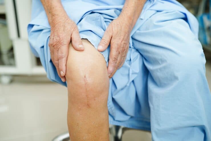 Orthopaedic surgical care for knee replacement